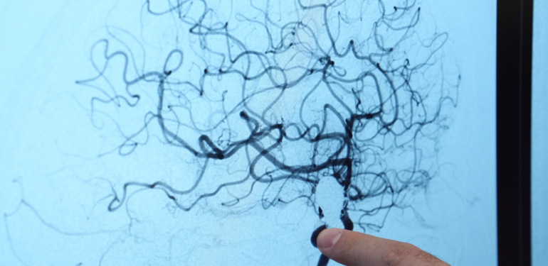 Doktorlar uyardı, her 20 kişiden 1’inde görülüyor