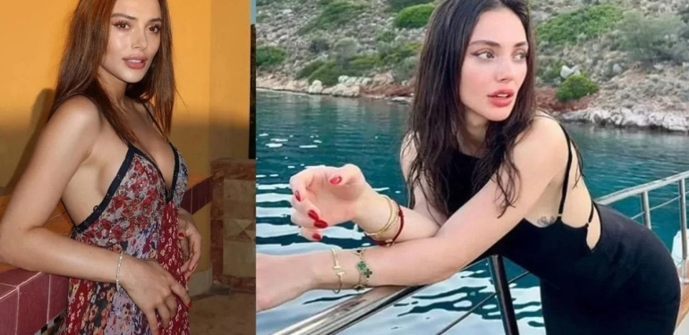 TRT dizisinde set kazası! Ünlü oyuncunun parmağı kopma noktasına geldi